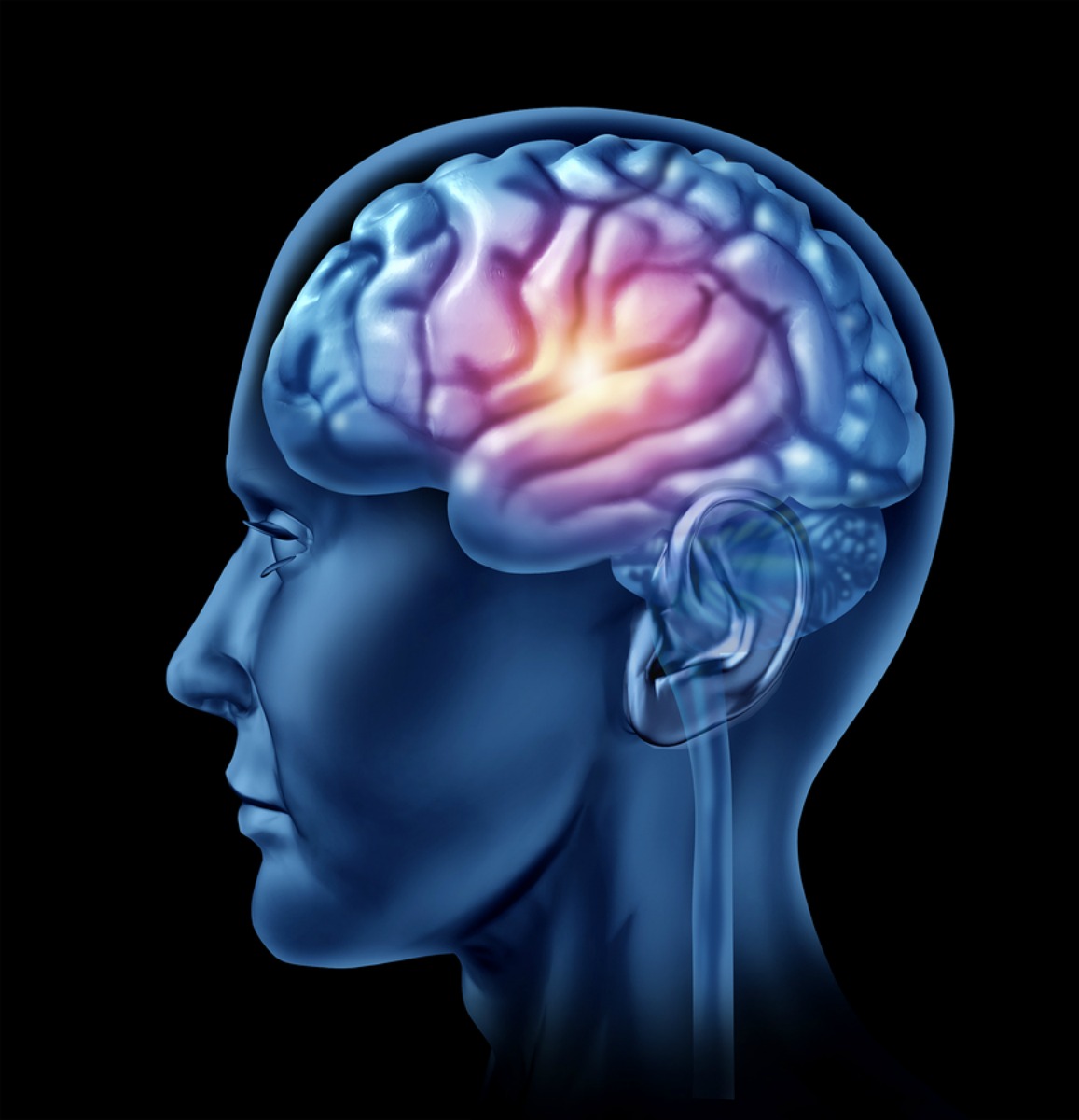Home Care in Saratoga CA: Brain Tumor Symptoms