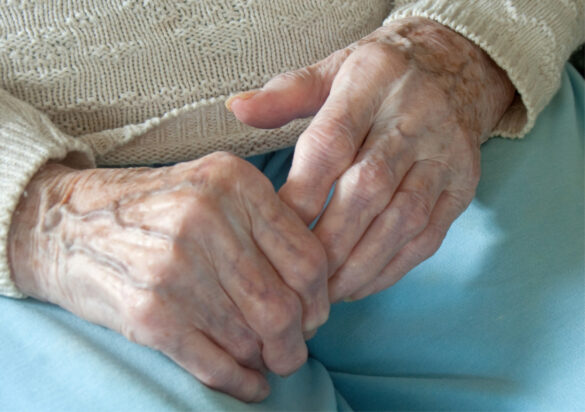Senior Care Tips: Arthritis